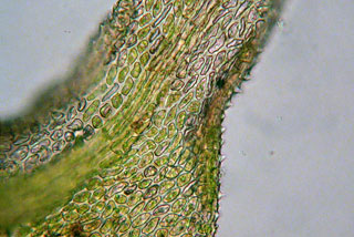 Thuidium cells