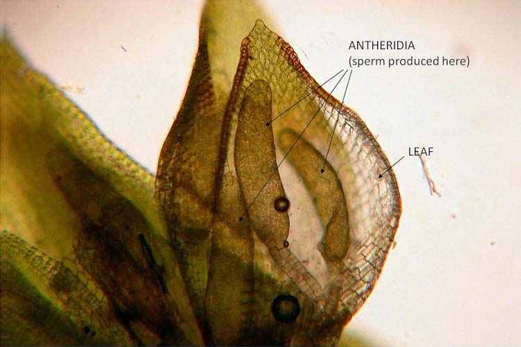 Orthotrichum-pumillum-antheridia