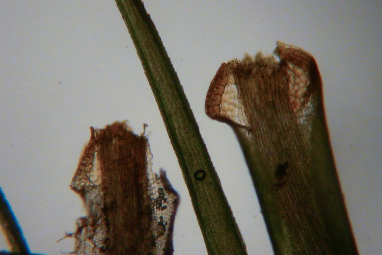 Dicranum fulvum leaves. Nore brown alar cells.